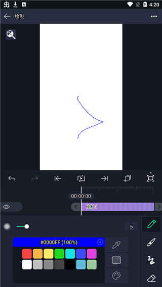 AMͼ2